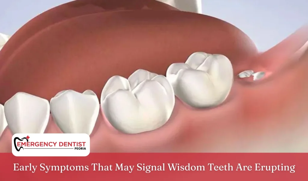 Early Symptoms That May Signal Wisdom Teeth Are Erupting