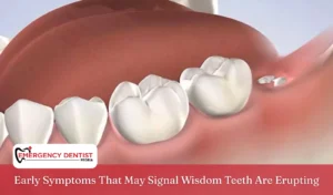 Early Symptoms That May Signal Wisdom Teeth Are Erupting