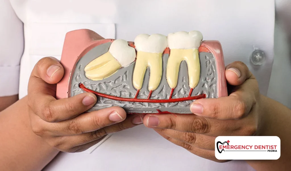 Wisdom Tooth Pain vs. Normal Pressure