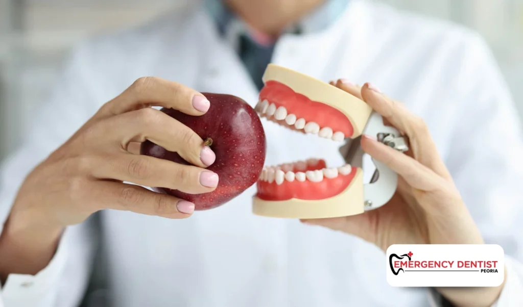 Common Causes of Chipped Teeth