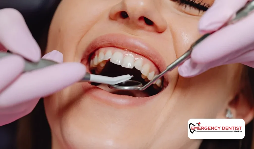 Dental Treatments for Repairing a Chipped Tooth
