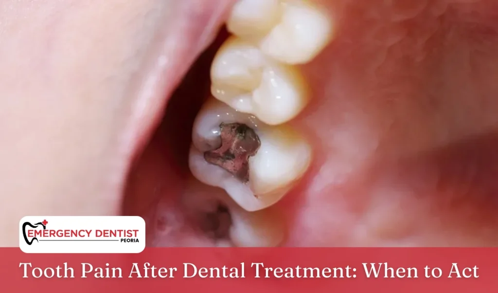 Tooth Pain After Dental Treatment When to Act