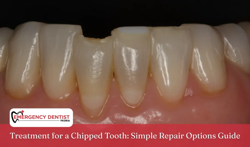 Treatment for a Chipped Tooth Simple Repair Options Guide