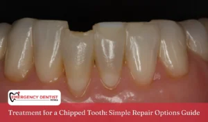 Treatment for a Chipped Tooth Simple Repair Options Guide