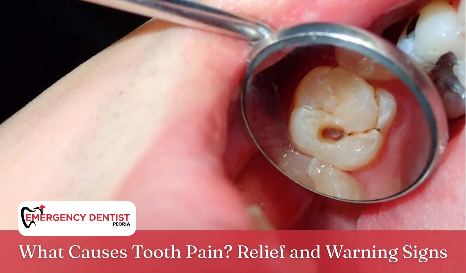 What Causes Tooth Pain Relief and Warning Signs