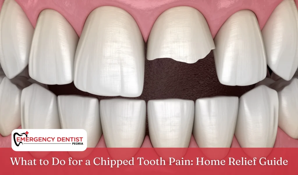 What to Do for a Chipped Tooth Pain Home Relief Guide