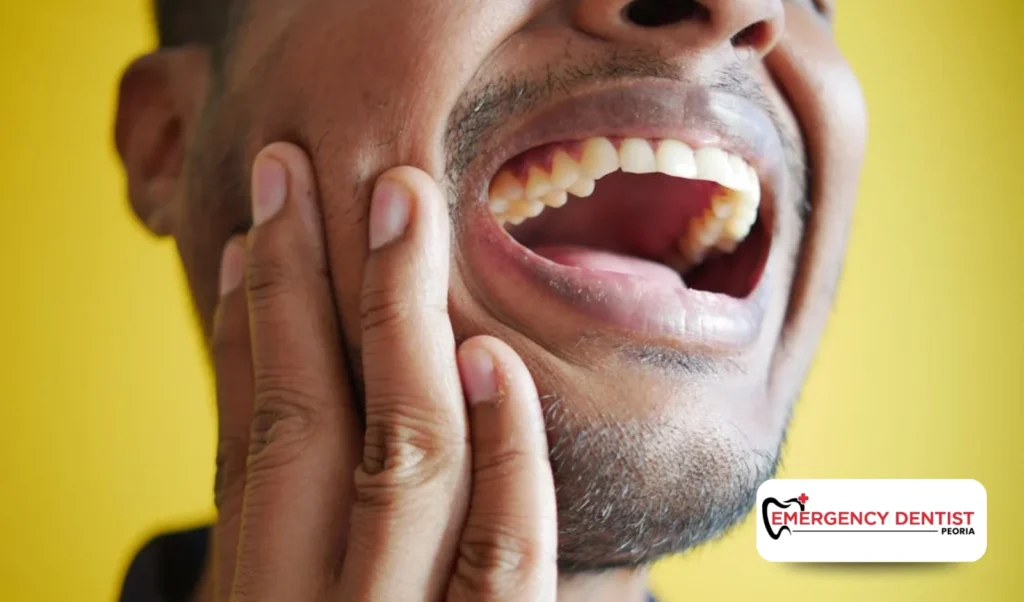 When to See an Emergency Dentist in Peoria