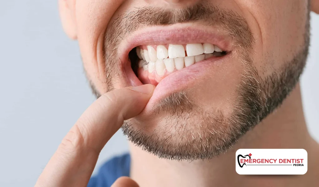 Why Does Tooth Pain Start?