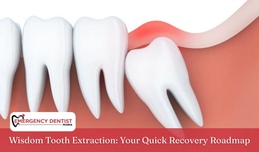 Wisdom Tooth Extraction Your Quick Recovery Roadmap