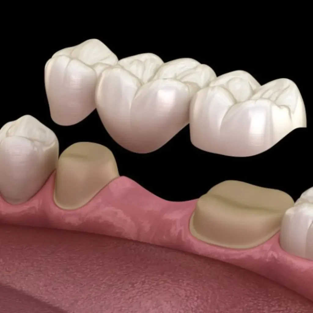 Accidental-damage-from-injury-or-biting-down-Peoria-AZ