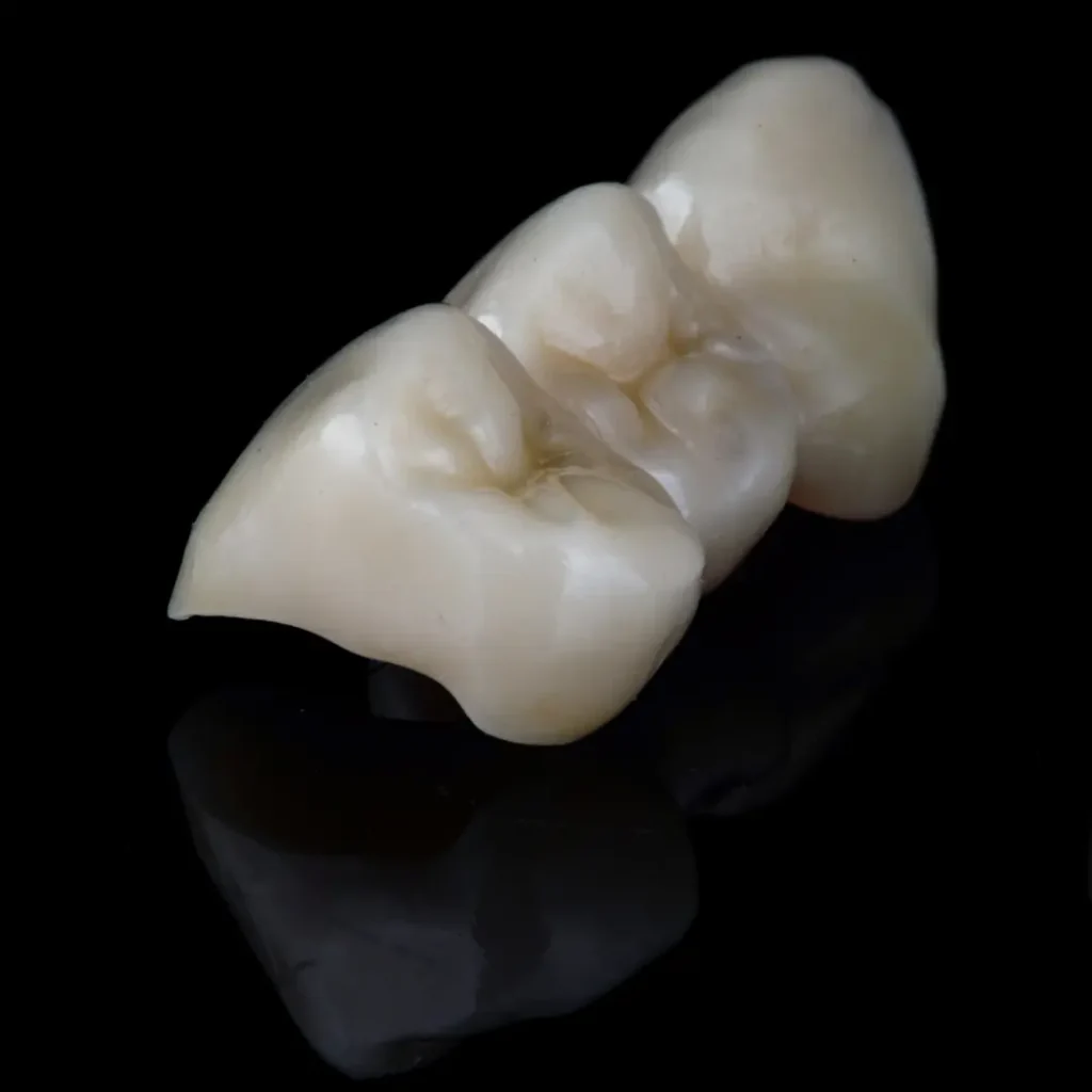 Broken-or-cracked-dental-bridge-Peoria-AZ