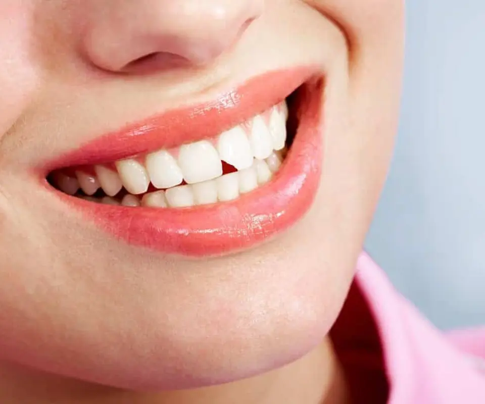 Chipped-Teeth-Peoria-AZ