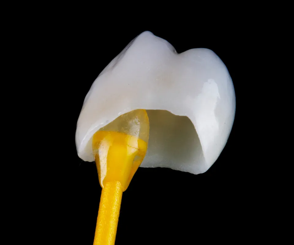 Dental-Crowns-Peoria-AZ