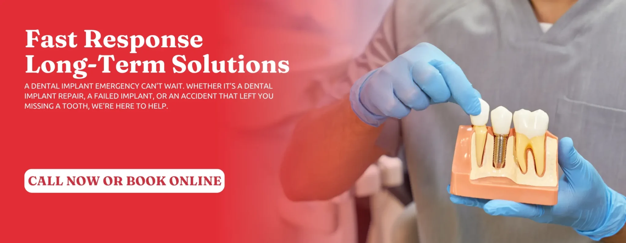 Dental-Implant-Solutions-in-Peoria-AZ