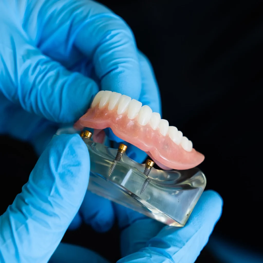 Emergency-Denture-Repairs-Peoria-AZ