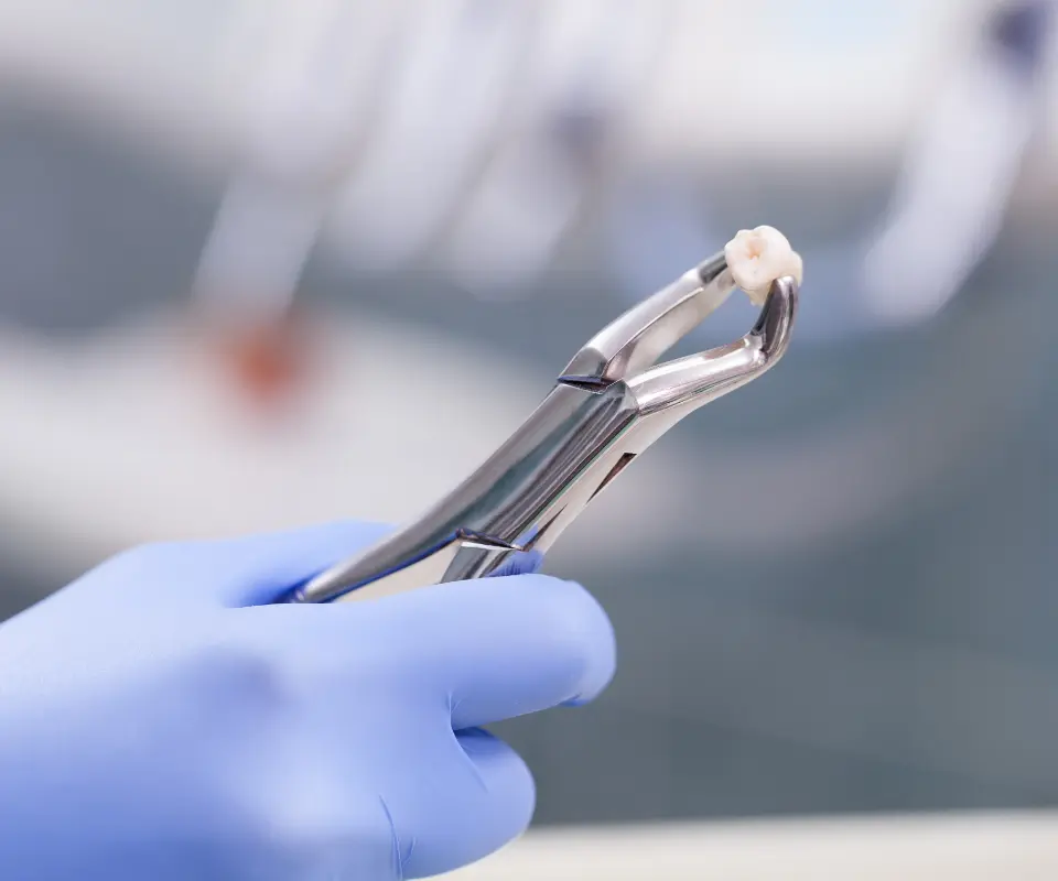 Emergency-Extraction-Peoria-AZ
