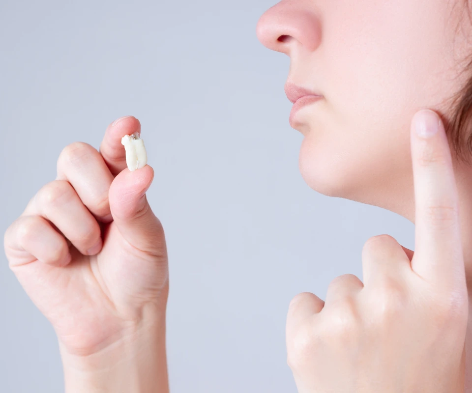 Emergency-Wisdom-Tooth-Extraction-Peoria-AZ