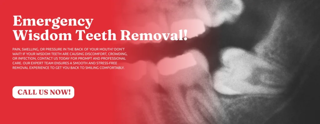 Emergency-Wisdom-Tooth-Removal-Peoria-AZ