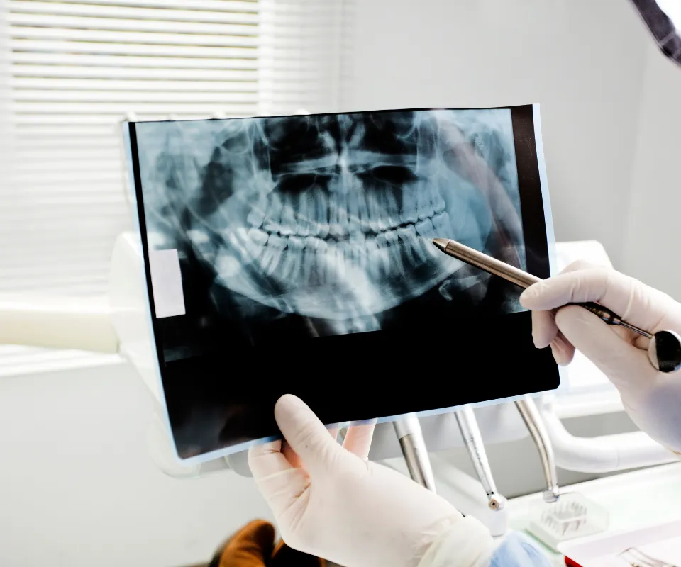 Emergency-dental-X-rays-Peoria-AZ