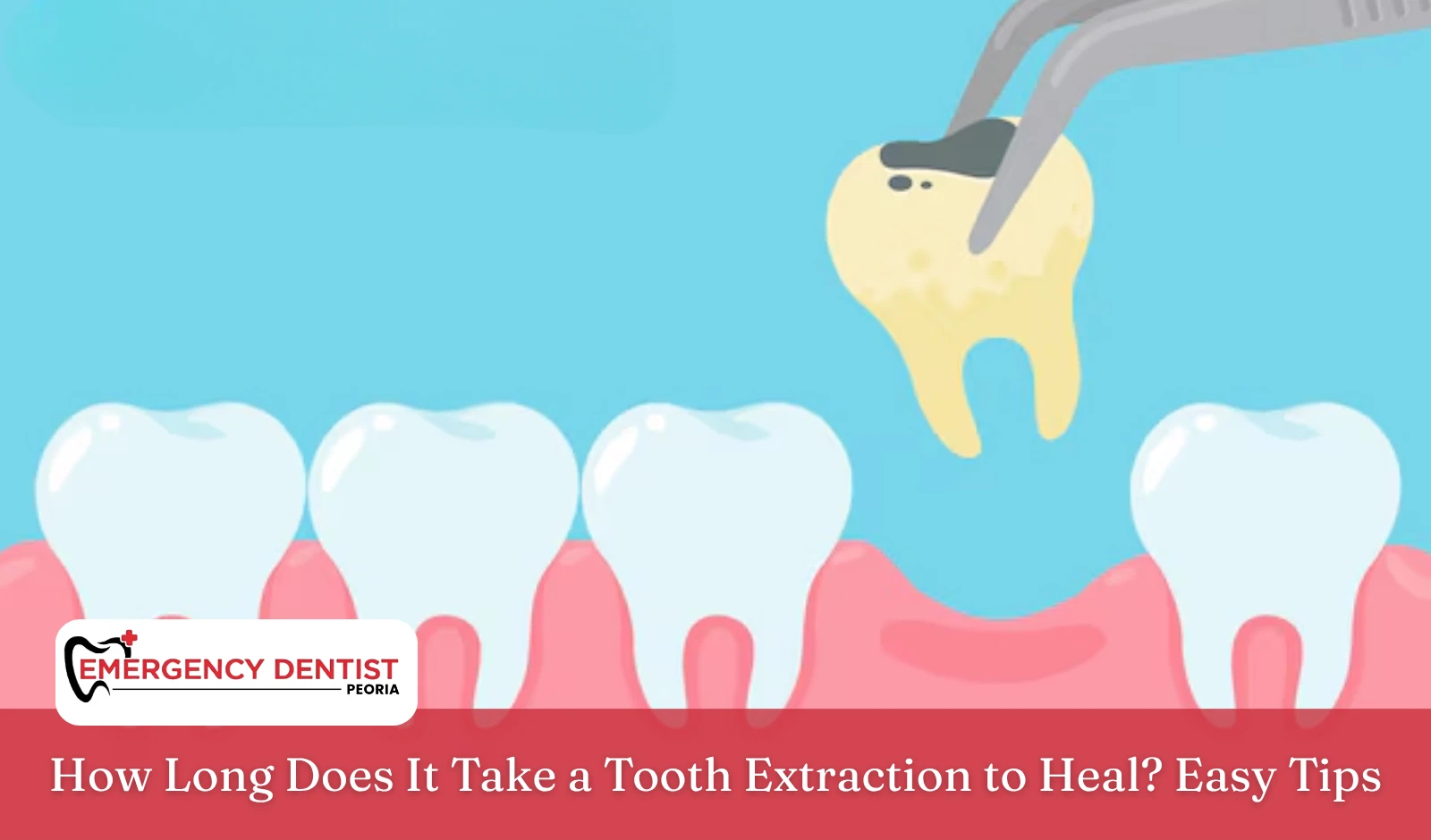 how-long-tooth-extraction-heal-tips