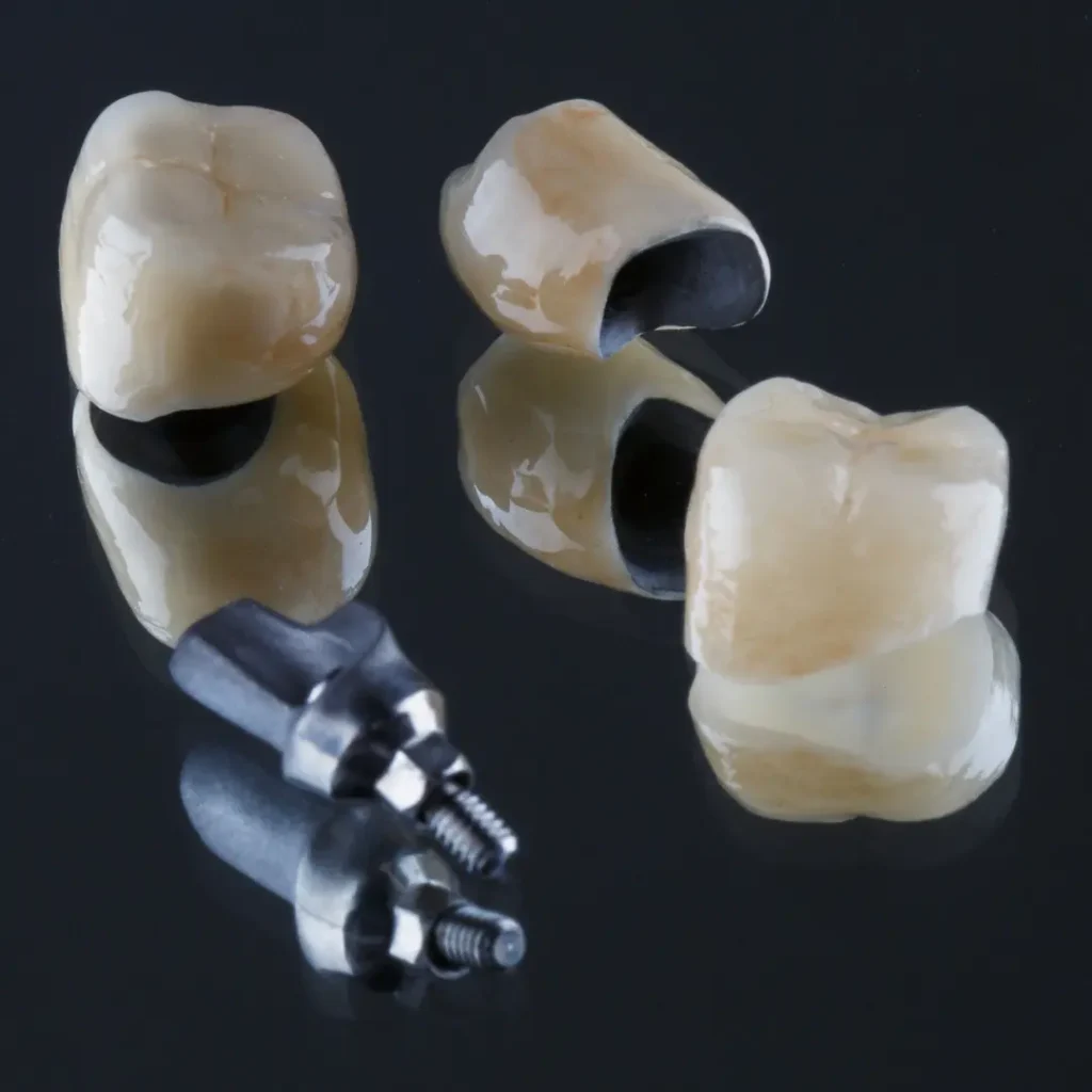 Loose-dental-bridge-or-crown-Peoria-AZ