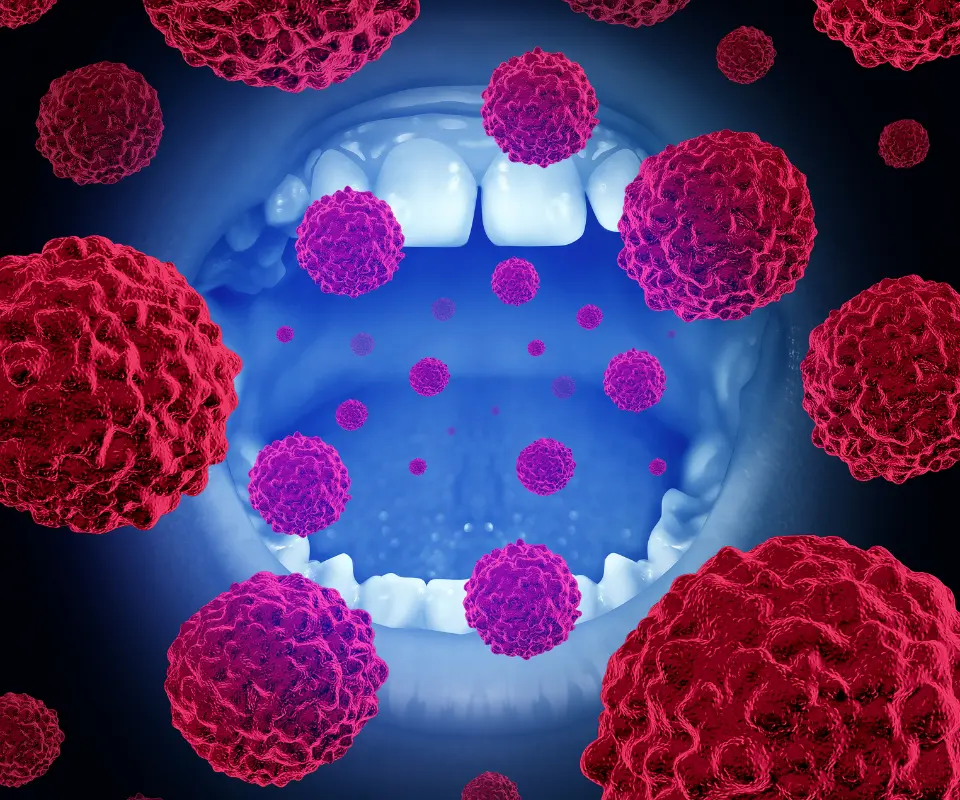 Oral-Cancer-Peoria-AZ