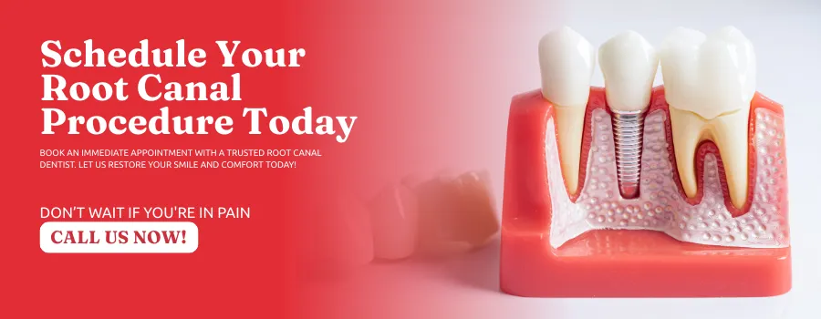 Root-Canal-Procedure-in-Peoria-AZ