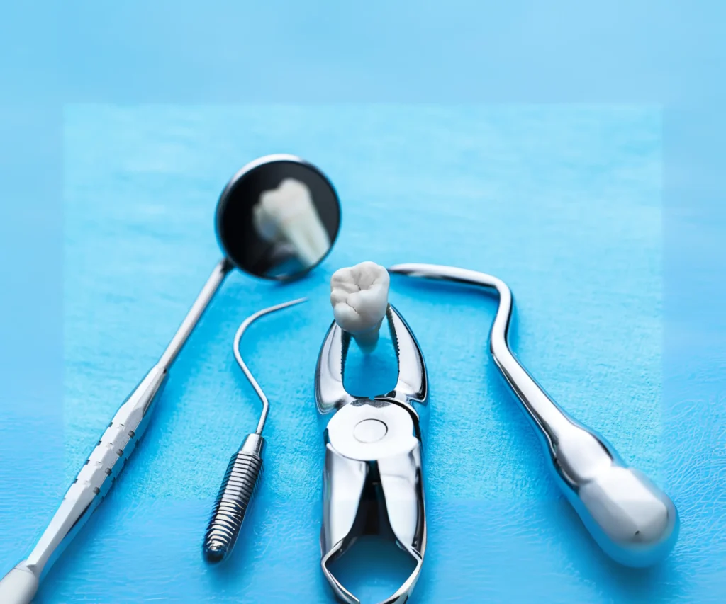 Simple-Tooth-Extractions-Peoria-AZ