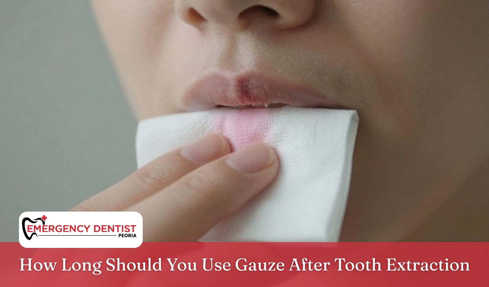 how-long-to-use-gauze-after-tooth-extraction