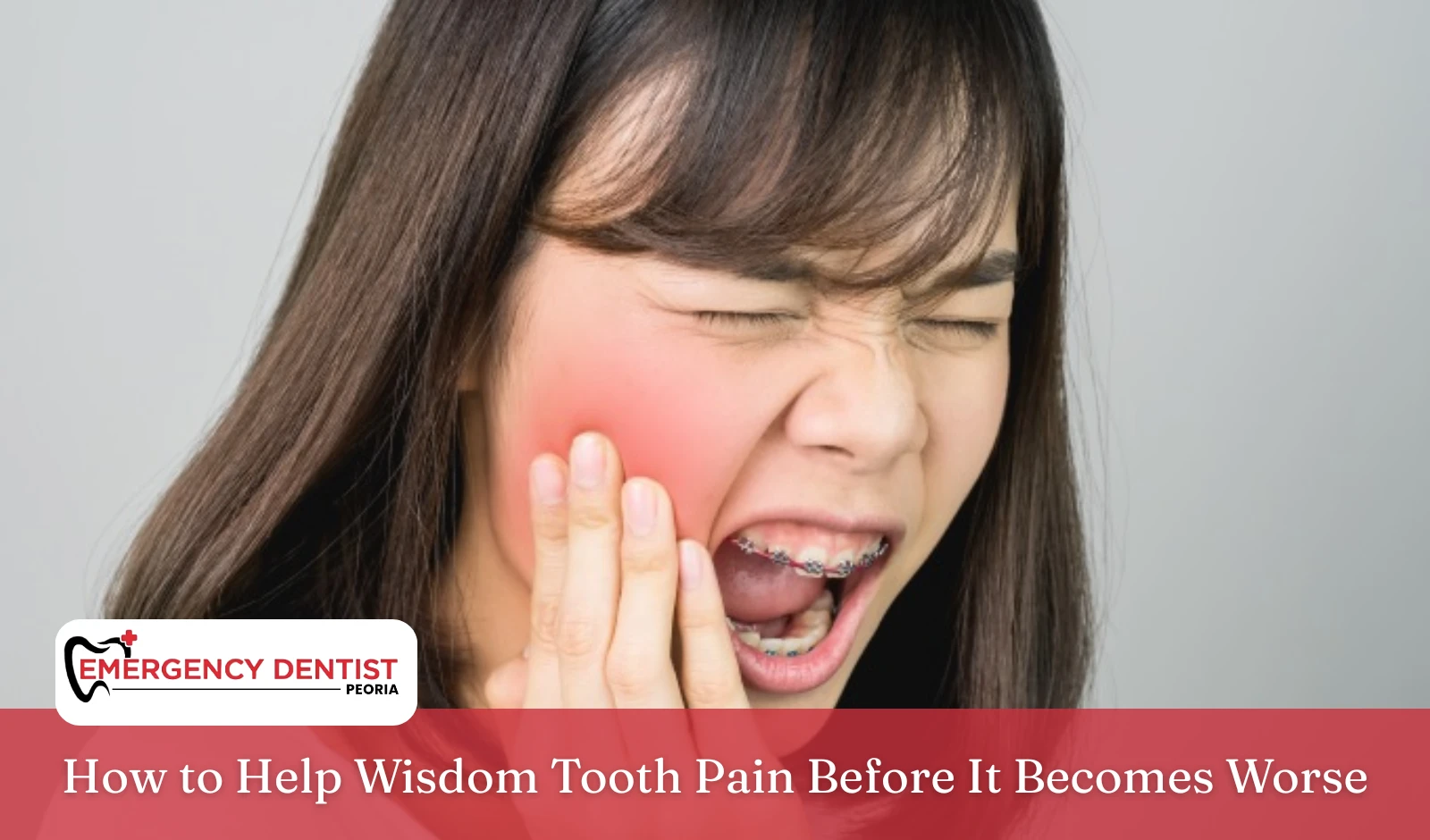 how-help-wisdom-tooth-pain