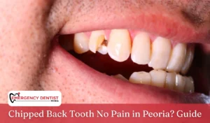 Chipped Back Tooth No Pain in Peoria Guide