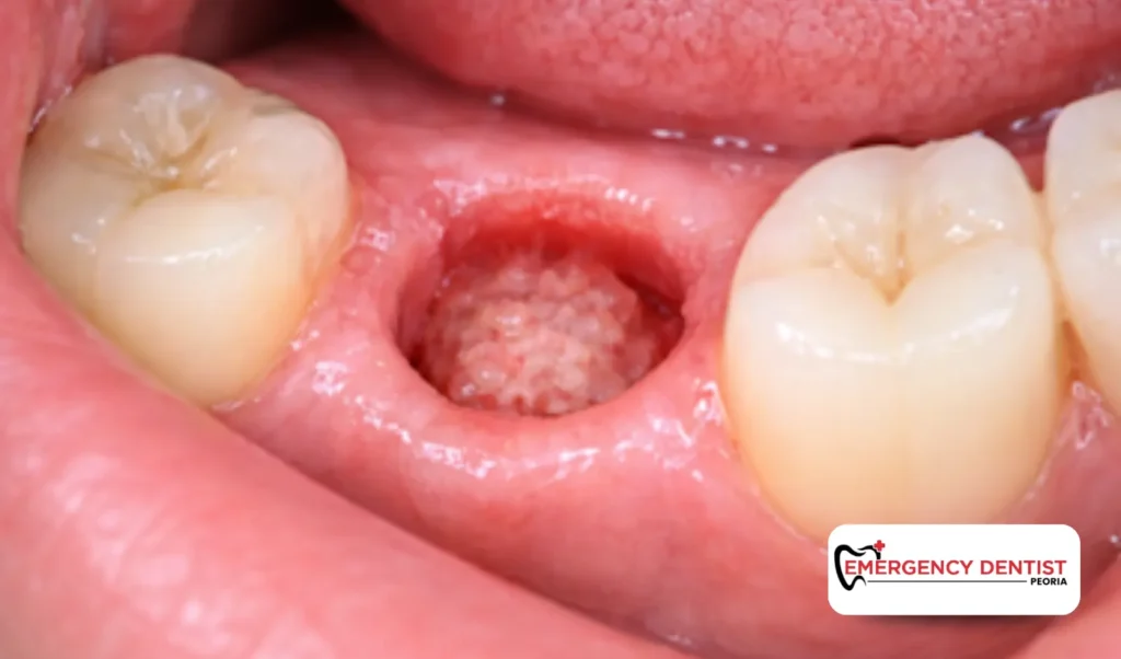 What Causes the White Appearance?